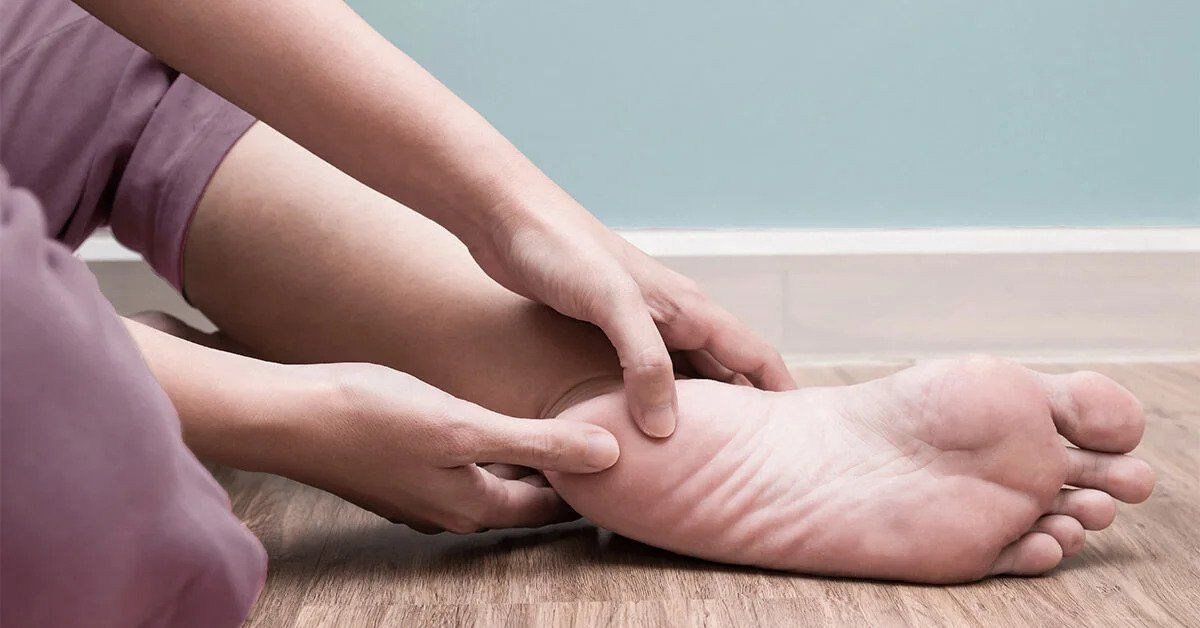 plantar fasciitis